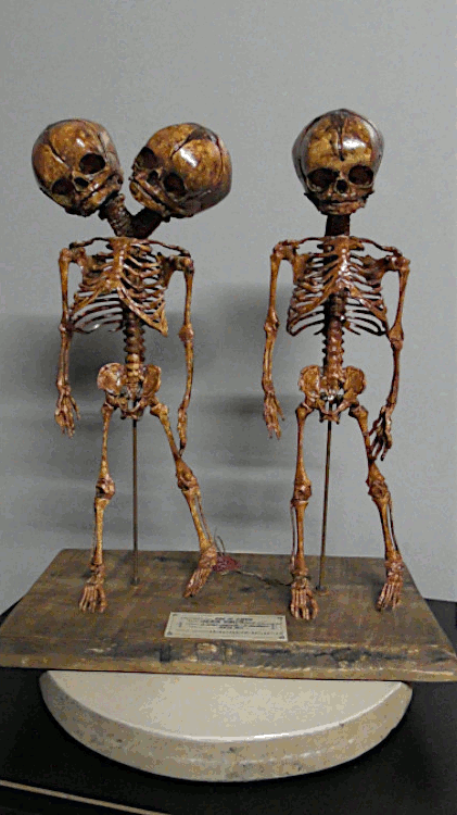 THE UNEQUAL TRIPLETS THE UNEQUAL TRIPLETS